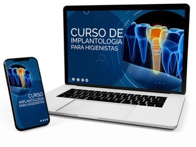 Curso de Implantologia para higienistas - HIDES 02